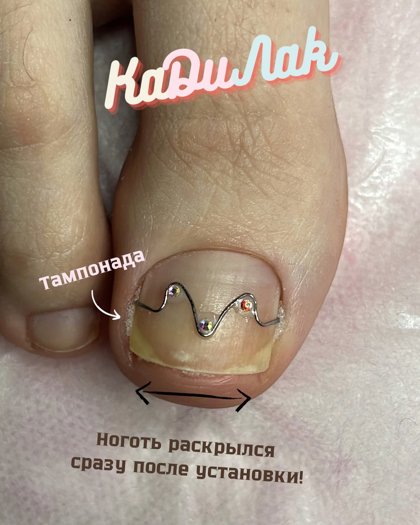 Диана