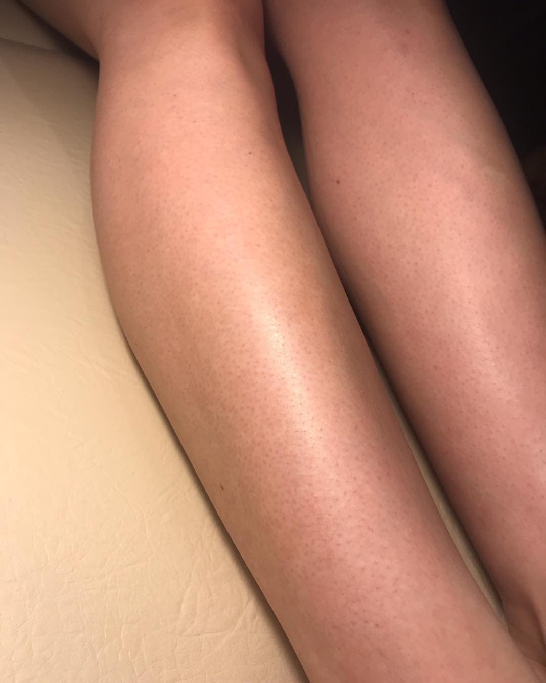 Gomelsugaring