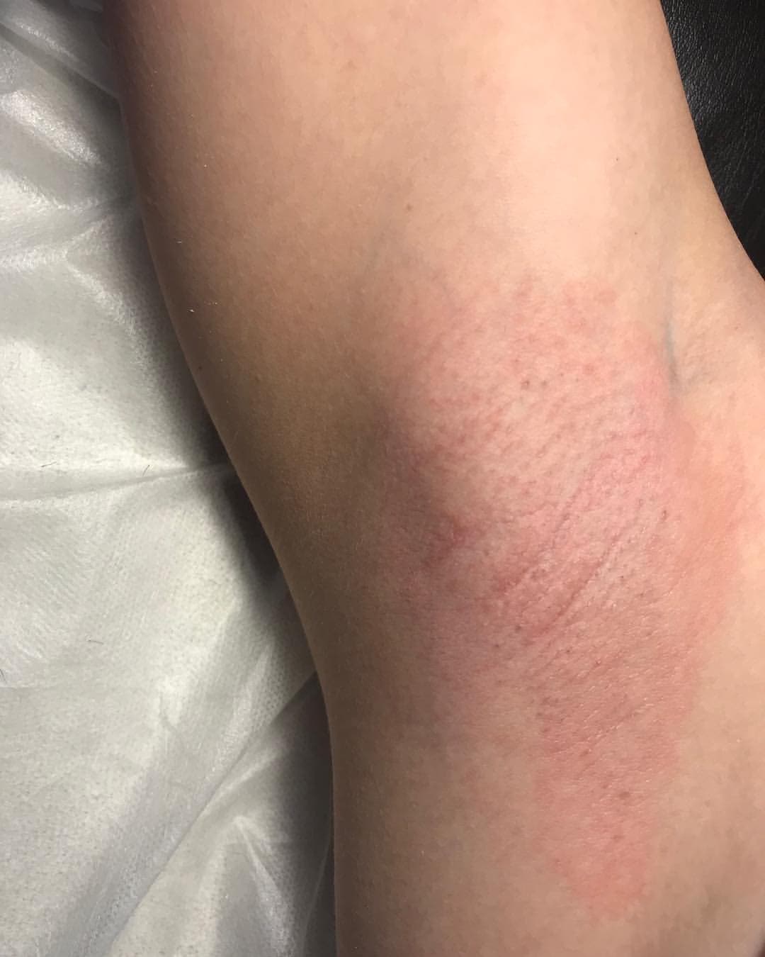 Gomelsugaring