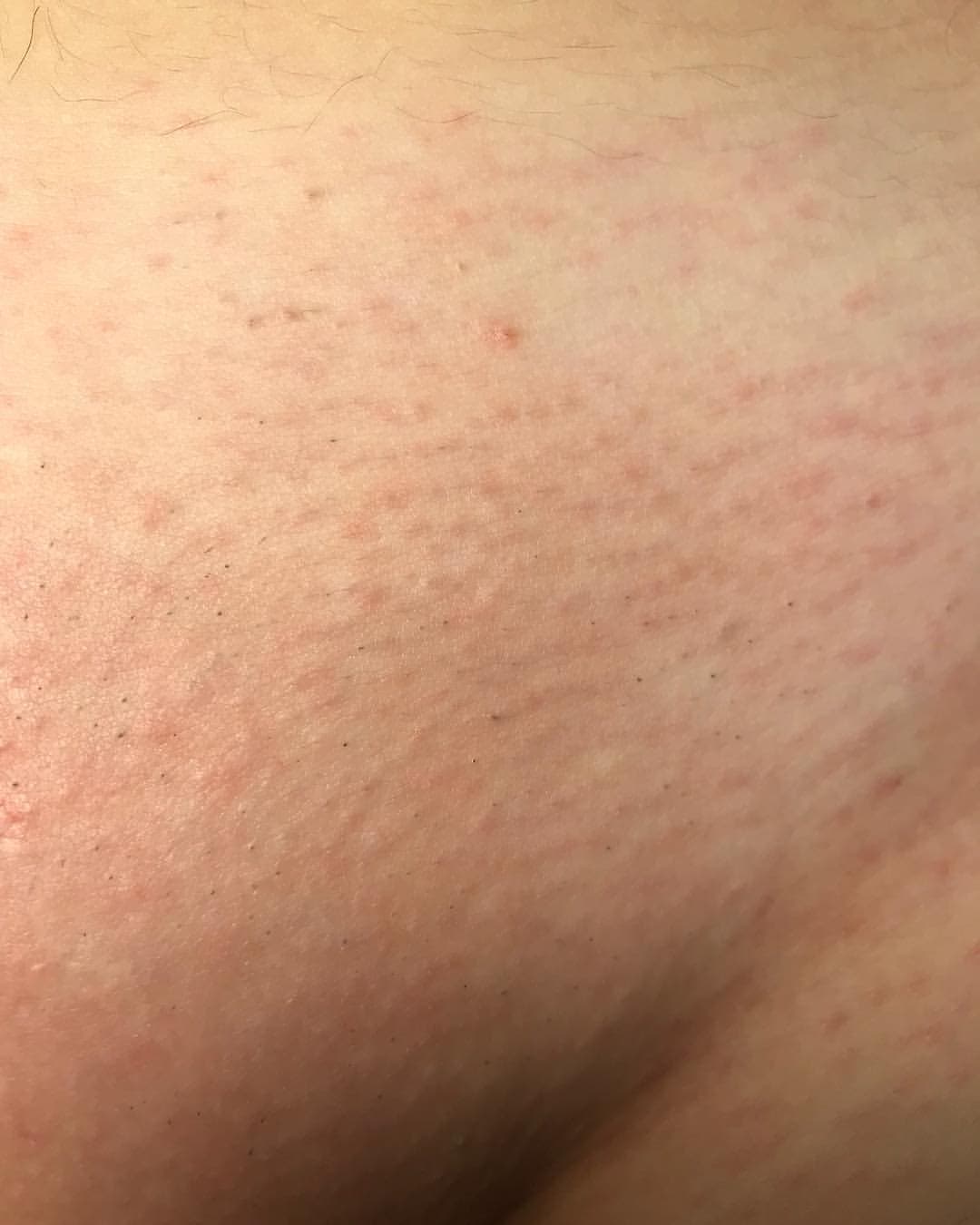 Gomelsugaring