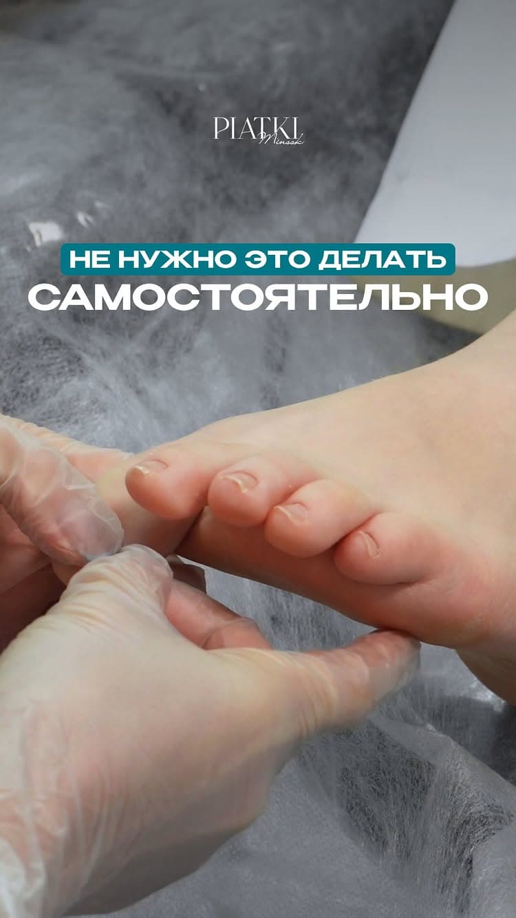 Студии подологии «Пятки»