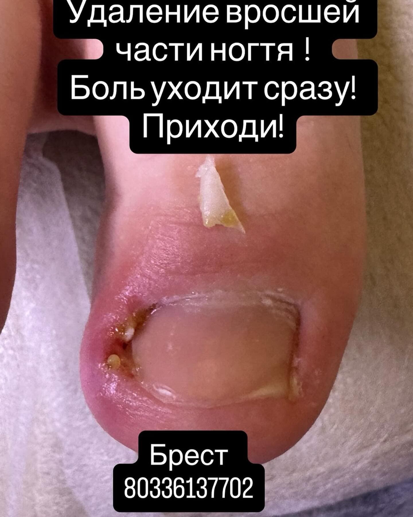 Алла Нуждева
